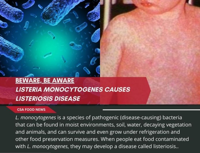 LISTERIA MONOCYTOGENES CAUSES LISTERIOSIS DISEASE